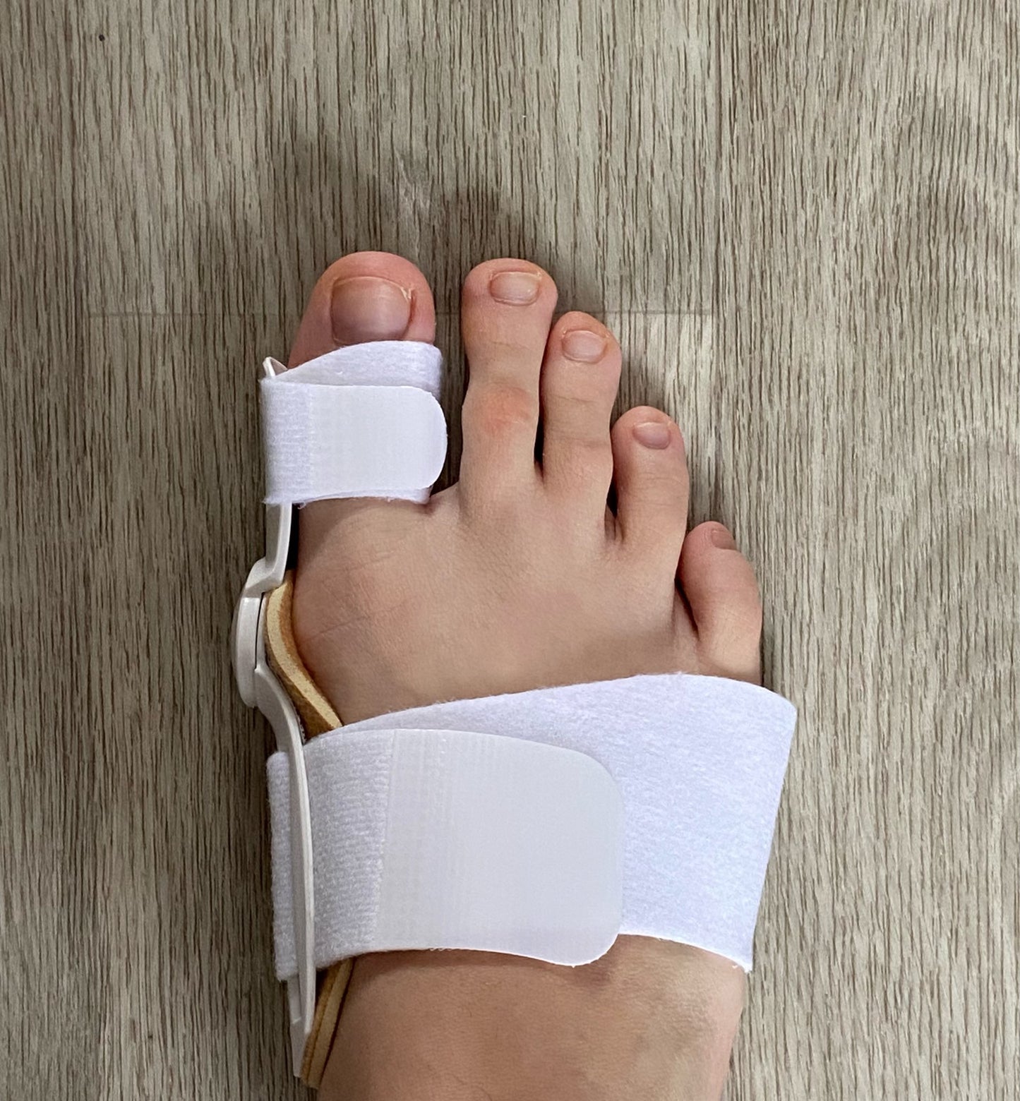 BunionFixed™ – Bunion Corrector Splint