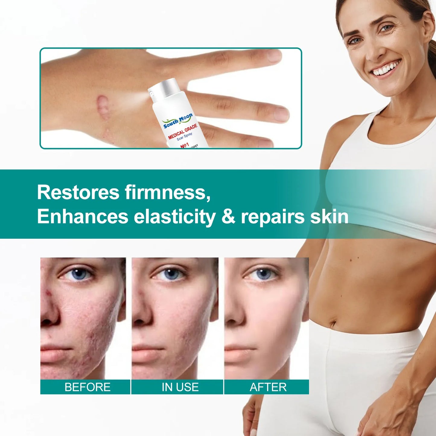 Scar Remover Spray Repair Stretch Mark Firming Body Treatment Streak Obesity Improve Smooth Skin Promote Collagen Activatio Care